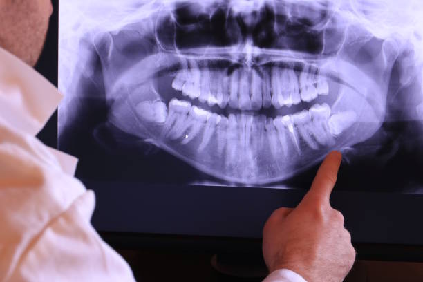 Best Emergency Dentist for Knocked-Out Tooth in Sour Lake, TX